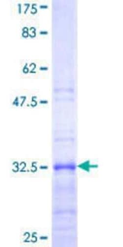 Novus Biologicals Recombinant Human RPL39 GST (N-Term) Protein 10 &mu;g | Buy Online | Novus Biologicals&trade; | Fisher Scientific