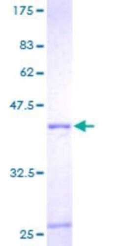 Novus Biologicals Recombinant Human RPL36A GST (N-Term) Protein 2 &mu;g | Buy Online | Novus Biologicals&trade; | Fisher Scientific