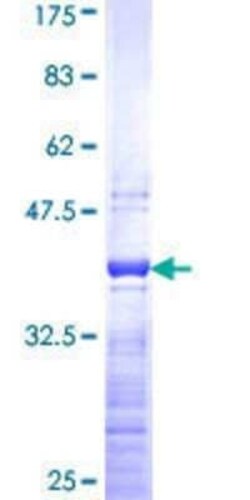 Novus Biologicals Recombinant Human RPL36A GST (N-Term) Protein 2 &mu;g | Buy Online | Novus Biologicals&trade; | Fisher Scientific