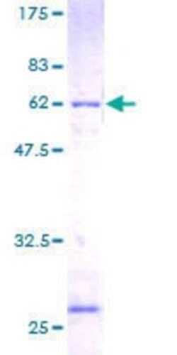 Novus Biologicals Recombinant Human RPLP0 GST (N-Term) Protein 25 &mu;g | Buy Online | Novus Biologicals&trade; | Fisher Scientific