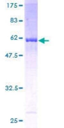 Novus Biologicals Recombinant Human RPLP0 GST (N-Term) Protein 25 &mu;g | Buy Online | Novus Biologicals&trade; | Fisher Scientific