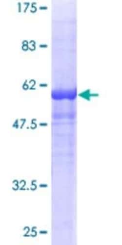 Novus Biologicals Recombinant Human RPLP0 GST (N-Term) Protein 10 &mu;g | Buy Online | Novus Biologicals&trade; | Fisher Scientific