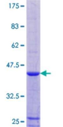 Novus Biologicals Recombinant Human RPLP1 GST (N-Term) Protein 10 &mu;g | Buy Online | Novus Biologicals&trade; | Fisher Scientific