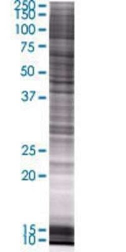 Novus Biologicals RPLP2 293T Cell Transient Overexpression Lysate 0.1 mL | Buy Online | Novus Biologicals&trade; | Fisher Scientific