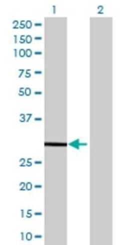 Novus Biologicals RPLP2 293T Cell Transient Overexpression Lysate 0.1 mL | Buy Online | Novus Biologicals&trade; | Fisher Scientific