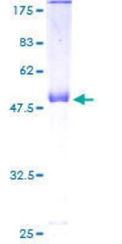 Novus Biologicals Recombinant Human MRPL12 GST (N-Term) Protein 10 &mu;g | Buy Online | Novus Biologicals&trade; | Fisher Scientific