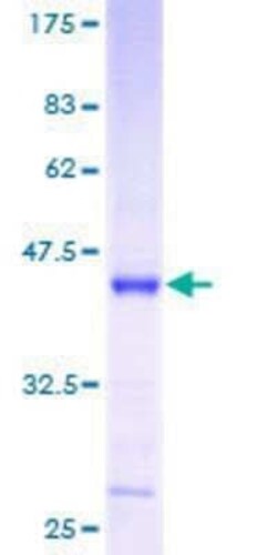 Novus Biologicals Recombinant Human MRPS12 GST (N-Term) Protein 25 &mu;g | Buy Online | Novus Biologicals&trade; | Fisher Scientific