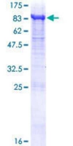 Novus Biologicals Recombinant Human Ribophorin II GST (N-Term) Protein 10 &mu;g | Buy Online | Novus Biologicals&trade; | Fisher Scientific