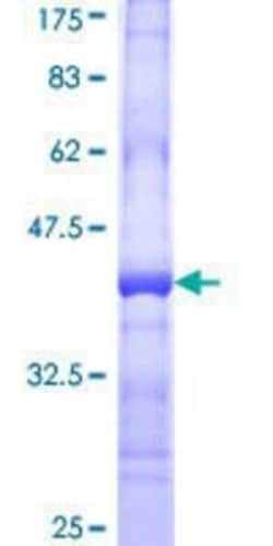Novus Biologicals Recombinant Human Ribophorin II GST (N-Term) Protein 25 &mu;g | Buy Online | Novus Biologicals&trade; | Fisher Scientific