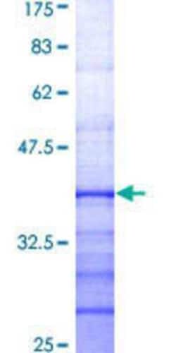 Novus Biologicals Recombinant Human RSK3 GST (N-Term) Protein 25 &mu;g | Buy Online | Novus Biologicals&trade; | Fisher Scientific