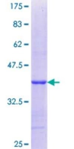 Novus Biologicals Recombinant Human RPS9 GST (N-Term) Protein 2 &mu;g | Buy Online | Novus Biologicals&trade; | Fisher Scientific