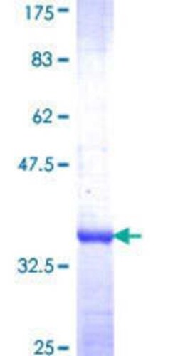 Novus Biologicals Recombinant Human RPS11 GST (N-Term) Protein 25 &mu;g | Buy Online | Novus Biologicals&trade; | Fisher Scientific