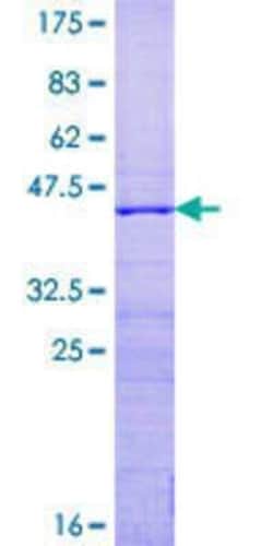 Novus Biologicals Recombinant Human RPS15 GST (N-Term) Protein 10 &mu;g | Buy Online | Novus Biologicals&trade; | Fisher Scientific