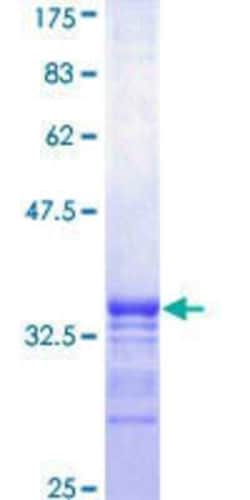 Novus Biologicals Recombinant Human RPS15 GST (N-Term) Protein 25 &mu;g | Buy Online | Novus Biologicals&trade; | Fisher Scientific