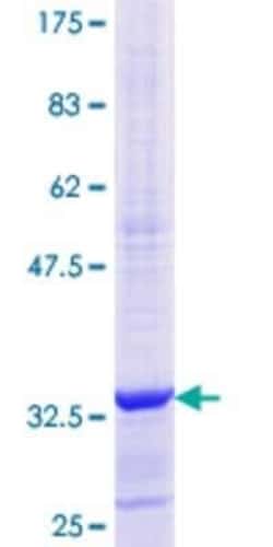 Novus Biologicals Recombinant Human RPS15A GST (N-Term) Protein 10 &mu;g | Buy Online | Novus Biologicals&trade; | Fisher Scientific