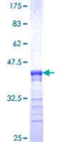 Novus Biologicals Recombinant Human RPS17 GST (N-Term) Protein 25 &mu;g | Buy Online | Novus Biologicals&trade; | Fisher Scientific