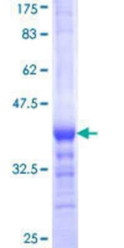 Novus Biologicals Recombinant Human RPS21 GST (N-Term) Protein 25 &mu;g | Buy Online | Novus Biologicals&trade; | Fisher Scientific