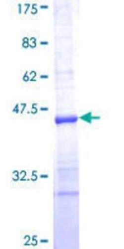 Novus Biologicals Recombinant Human RPS23 GST (N-Term) Protein 10 &mu;g | Buy Online | Novus Biologicals&trade; | Fisher Scientific