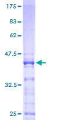 Novus Biologicals Recombinant Human RPS25 GST (N-Term) Protein 10 &mu;g | Buy Online | Novus Biologicals&trade; | Fisher Scientific