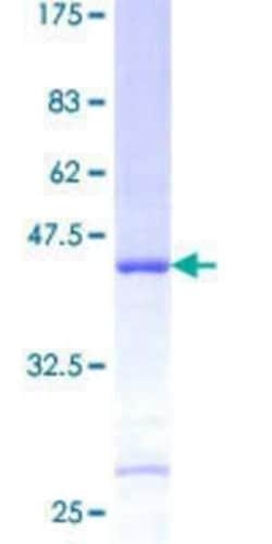 Novus Biologicals Recombinant Human RPS26 GST (N-Term) Protein 25 &mu;g | Buy Online | Novus Biologicals&trade; | Fisher Scientific
