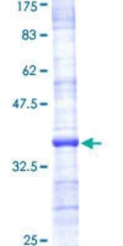 Novus Biologicals Recombinant Human RPS26 GST (N-Term) Protein 10 &mu;g | Buy Online | Novus Biologicals&trade; | Fisher Scientific