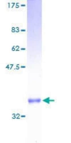 Novus Biologicals Recombinant Human Ribosomal protein S27 GST (N-Term) Protein 10 &mu;g | Buy Online | Novus Biologicals&trade; | Fisher Scientific