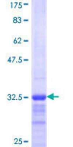 Novus Biologicals Recombinant Human Ribosomal Protein S29 GST (N-Term) Protein 10 &mu;g | Buy Online | Novus Biologicals&trade; | Fisher Scientific