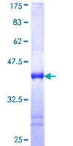 Novus Biologicals Recombinant Human RRAD GST (N-Term) Protein 25 &mu;g | Buy Online | Novus Biologicals&trade; | Fisher Scientific