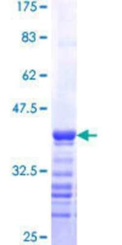Novus Biologicals Recombinant Human RTKN GST (N-Term) Protein 25 &mu;g | Buy Online | Novus Biologicals&trade; | Fisher Scientific