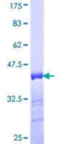 Novus Biologicals Recombinant Human RSC1A1 GST (N-Term) Protein 10 &mu;g | Buy Online | Novus Biologicals&trade; | Fisher Scientific