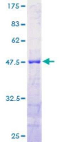 Novus Biologicals&trade;&nbsp;Recombinant Human RTN1-A/NSP GST (N-Term) Protein