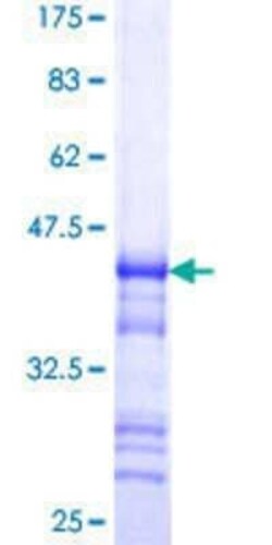 Novus Biologicals Recombinant Human Reticulon 2 GST (N-Term) Protein 10 &mu;g | Buy Online | Novus Biologicals&trade; | Fisher Scientific