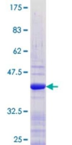 Novus Biologicals Recombinant Human RXR beta/NR2B2 GST (N-Term) Protein 10 &mu;g | Buy Online | Novus Biologicals&trade; | Fisher Scientific