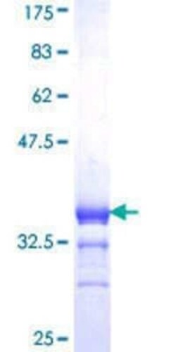 Novus Biologicals Recombinant Human RXR gamma/NR2B3 GST (N-Term) Protein 10 &mu;g | Buy Online | Novus Biologicals&trade; | Fisher Scientific