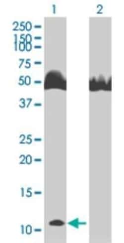 Novus Biologicals S100A8 293T Cell Transient Overexpression Lysate 0.1 mL | Buy Online | Novus Biologicals&trade; | Fisher Scientific