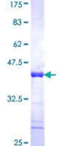 Novus Biologicals Recombinant Human SAFB GST (N-Term) Protein 25 &mu;g | Buy Online | Novus Biologicals&trade; | Fisher Scientific