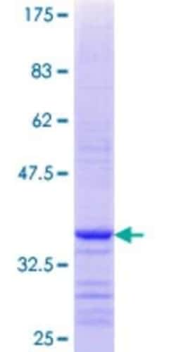 Novus Biologicals Recombinant Human ACSM3 GST (N-Term) Protein 25 &mu;g | Buy Online | Novus Biologicals&trade; | Fisher Scientific