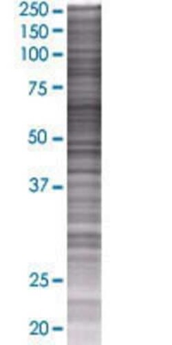 Novus Biologicals&trade;&nbsp;ACSM3 293T Cell Transient Overexpression Lysate