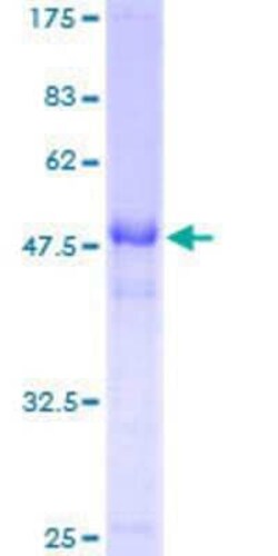 Novus Biologicals Recombinant Human SALL2 GST (N-Term) Protein 25 &mu;g | Buy Online | Novus Biologicals&trade; | Fisher Scientific