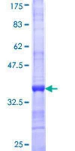 Novus Biologicals&trade;&nbsp;Recombinant Human SC5DL GST (N-Term) Protein
