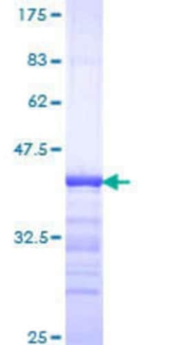 Novus Biologicals&trade;&nbsp;Recombinant Human Ataxin-2 GST (N-Term) Protein
