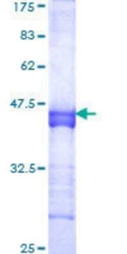 Novus Biologicals Recombinant Human SCmL1 GST (N-Term) Protein 25 &mu;g | Buy Online | Novus Biologicals&trade; | Fisher Scientific