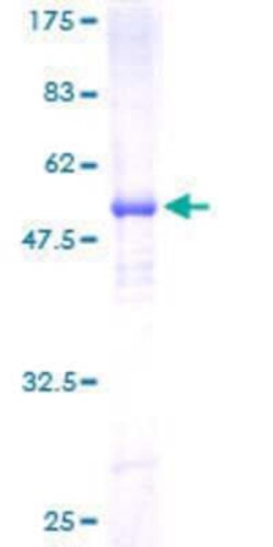 Novus Biologicals Recombinant Human Scn2b GST (N-Term) Protein 25 &mu;g | Buy Online | Novus Biologicals&trade; | Fisher Scientific