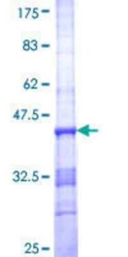 Novus Biologicals Recombinant Human SCN3A GST (N-Term) Protein 10 &mu;g | Buy Online | Novus Biologicals&trade; | Fisher Scientific