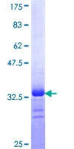 Novus Biologicals Recombinant Human Nav1.7 GST (N-Term) Protein 10 &mu;g | Buy Online | Novus Biologicals&trade; | Fisher Scientific