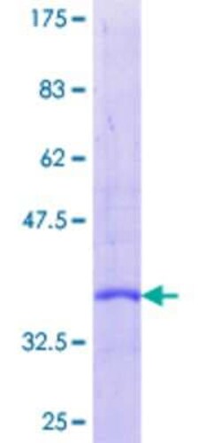 Novus Biologicals™ Recombinant Human Secretin GST (N-Term) Protein