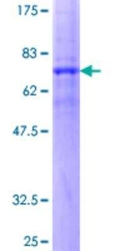 Novus Biologicals Recombinant Human Secretin R GST (N-Term) Protein 10 &mu;g | Buy Online | Novus Biologicals&trade; | Fisher Scientific