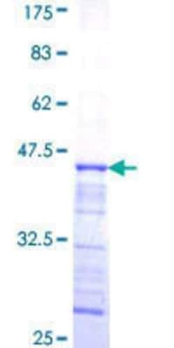 Novus Biologicals Recombinant Human Secretin R GST (N-Term) Protein 25 &mu;g | Buy Online | Novus Biologicals&trade; | Fisher Scientific