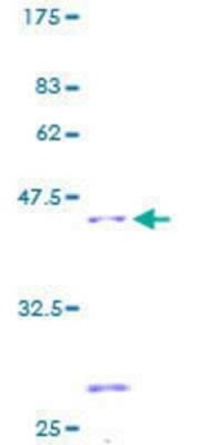 Novus Biologicals Recombinant Human SDHC GST (N-Term) Protein 2 &mu;g | Buy Online | Novus Biologicals&trade; | Fisher Scientific