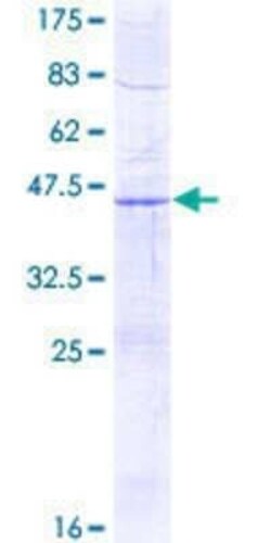 Novus Biologicals Recombinant Human SDHD GST (N-Term) Protein 25 &mu;g | Buy Online | Novus Biologicals&trade; | Fisher Scientific